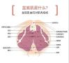 盆底电没痛感就没效果？九成女性都调错强度，易舒美教你正确修复