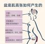 盆底肌修复，你可能从一开始就练反了
